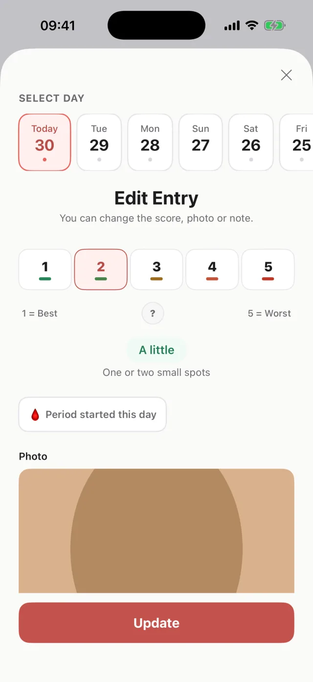 Daily entry screen with a 1-5 score and a photo