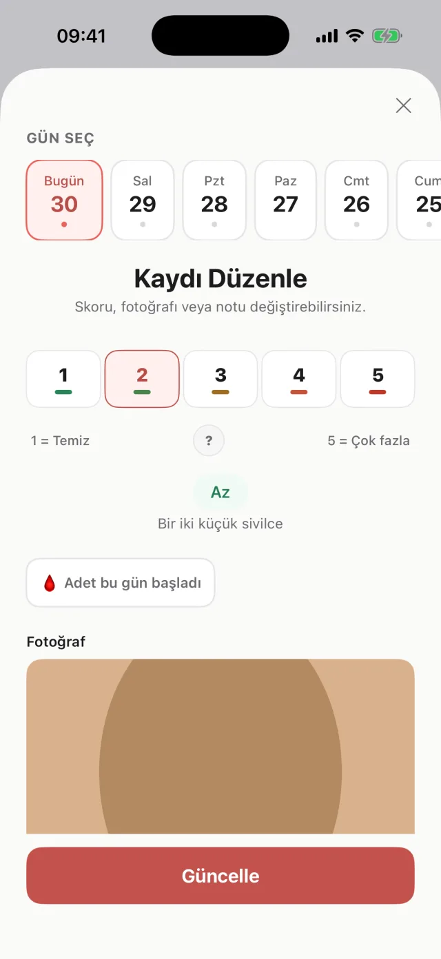 Günlük kayıt ekranı: 1-5 skor ve fotoğraf